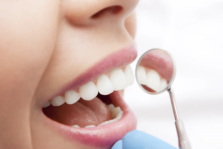 Dentist looking at a patients teeth with a small mirror.