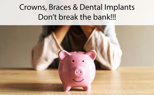 Crowns, Braces and Dental Implants.  Dont't break the bank.